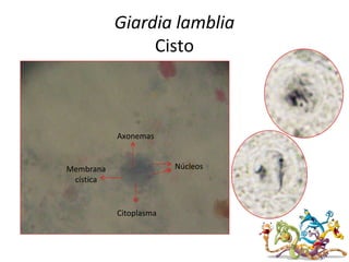 Giardia lamblia
Cisto
Núcleos
Axonemas
Citoplasma
Membrana
cística
 