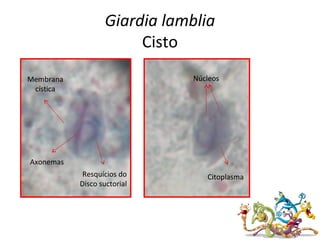 Núcleos
Axonemas
Citoplasma
Membrana
cística
Resquícios do
Disco suctorial
Giardia lamblia
Cisto
 