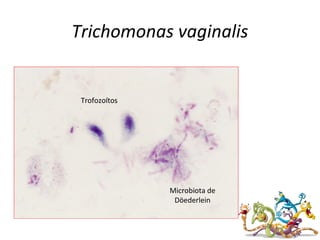 Trichomonas vaginalis
Trofozoítos
Microbiota de
Döederlein
 