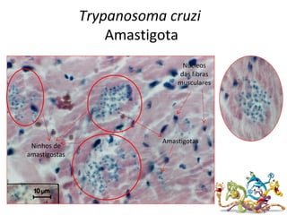 Trypanosoma cruzi
Amastigota
Ninhos de
amastigostas
Amastigotas
Núcleos
das fibras
musculares
 