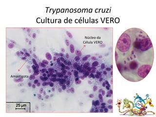 Trypanosoma cruzi
Cultura de células VERO
Amastigota
Núcleo da
Célula VERO
 