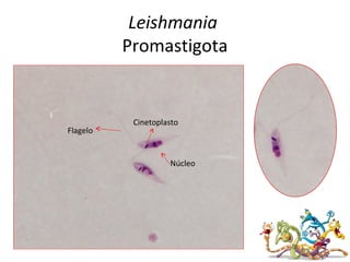 Leishmania
Promastigota
Flagelo
Cinetoplasto
Núcleo
 