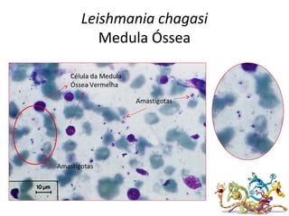 Leishmania chagasi
Medula Óssea
Amastigotas
Célula da Medula
Óssea Vermelha
Amastigotas
 