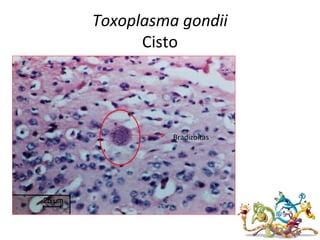 Toxoplasma gondii
Cisto
Bradizoítas
 