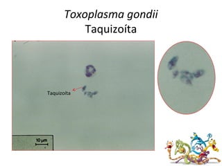 Toxoplasma gondii
Taquizoíta
Taquizoíta
 