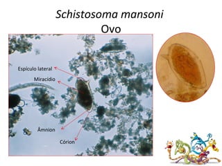 Schistosoma mansoni
Ovo
Espículo lateral
Córion
Âmnion
Miracídio
 