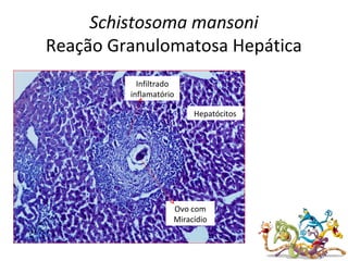 Schistosoma mansoni
Reação Granulomatosa Hepática
Ovo com
Miracídio
Infiltrado
inflamatório
Hepatócitos
 