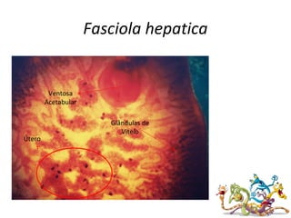 Fasciola hepatica
Glândulas de
Vitelo
Útero
Ventosa
Acetabular
 