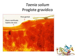 Taenia solium
Proglote gravídico
Poro genital
Útero ramificado
repleto de ovos
 