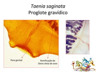 Taenia saginata
Proglote gravídico
Poro genital Ramificação do
Útero cheia de ovos
 