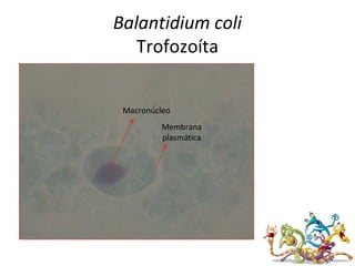 Balantidium coli
Trofozoíta
Macronúcleo
Membrana
plasmática
 