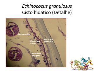 Echinococus granulosus
Cisto hidático (Detalhe)
 