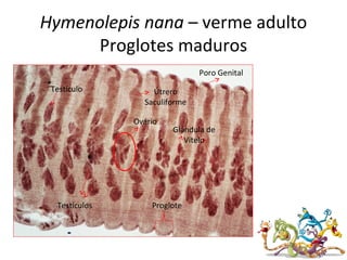 Hymenolepis nana – verme adulto
Proglotes maduros
Útrero
Saculiforme
Poro Genital
Ovário
Testículos
Testículo
Proglote
Glândula de
Vitelo
 
