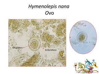 Hymenolepis nana
Ovo
Embrióforo
Oncosfera
 