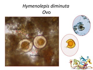 Hymenolepis diminuta
Ovo
Oncosfera
Embrióforo
 