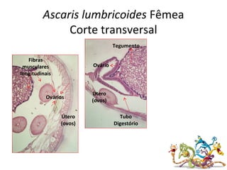 Ascaris lumbricoides Fêmea
Corte transversal
Ovário
Útero
(ovos)
Fibras
musculares
longitudinais
Tubo
Digestório
Tegumento
Ovários
Útero
(ovos)
 