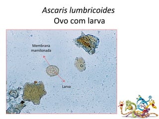 Ascaris lumbricoides
Ovo com larva
Larva
Membrana
mamilonada
 