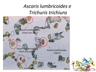 Ascaris lumbricoides e
Trichuris trichiura
Ascaris lumbricoides
infértil
Ascaris lumbricoides
Fértil sem casca
Ascaris lumbricoides
Fértil com casca
T. trichiurus
 