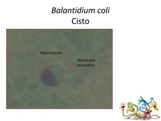 Balantidium coli
Cisto
Macronúcleo
Membrana
plasmática
 