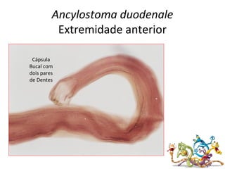 Ancylostoma duodenale
Extremidade anterior
Cápsula
Bucal com
dois pares
de Dentes
 