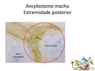 Ancylostoma macho
Extremidade posterior
Gubernáculo
Bolsa
Copuladora
 