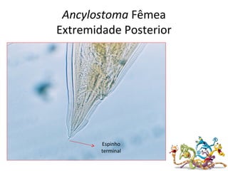 Ancylostoma Fêmea
Extremidade Posterior
Espinho
terminal
 
