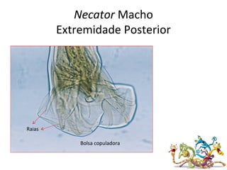 Necator Macho
Extremidade Posterior
Bolsa copuladora
Raias
 