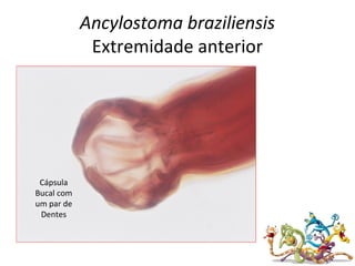 Ancylostoma braziliensis
Extremidade anterior
Cápsula
Bucal com
um par de
Dentes
 
