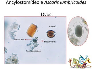 Ancylostomídeo e Ascaris lumbricoides
Ovos
Membrana
Blastômeros
Ascaris
Ancilostomídeo
 