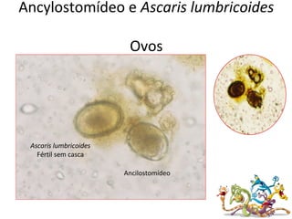 Ancylostomídeo e Ascaris lumbricoides
Ovos
Ancilostomídeo
Ascaris lumbricoides
Fértil sem casca
 