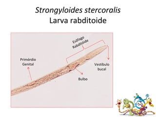 Strongyloides stercoralis
Larva rabditoide
Vestíbulo
bucal
Bulbo
Primórdio
Genital
Esôfago
Rabditóide
 