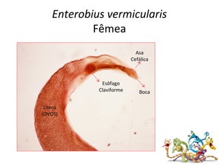 Enterobius vermicularis
Fêmea
Boca
Esôfago
Claviforme
Útero
(OVOS)
Asa
Cefálica
 