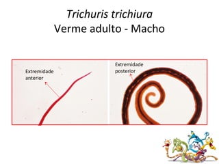 Trichuris trichiura
Verme adulto - Macho
Extremidade
anterior
Extremidade
posterior
 