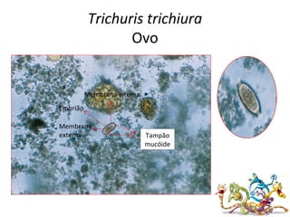 Trichuris trichiura
Ovo
Tampão
mucóide
Membrana
externa
Embrião
Membrana interna
 