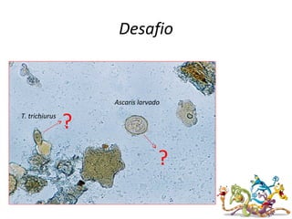 Desafio
Ascaris larvado
T. trichiurus
?
?
 