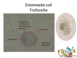 Entamoeba coli
Trofozoíta
Vacúolos
Cariossoma
Grânulos de
cromatina na
face interna da
carioteca
Membrana
plasmática
 
