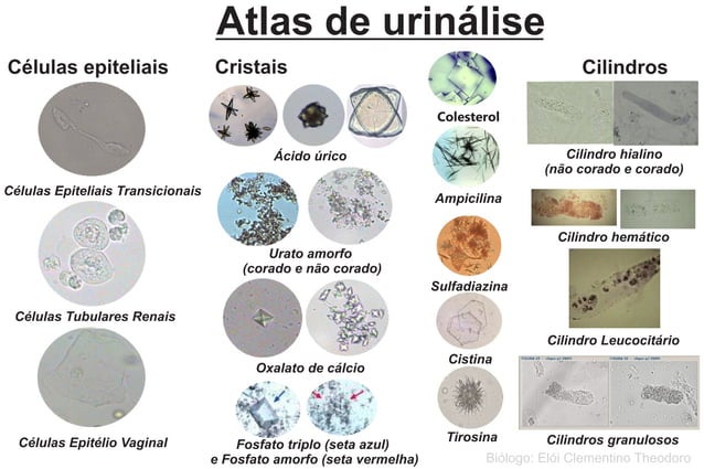 Celula Epitelial De Transicao Na Urina Resumo Sobre Classificações