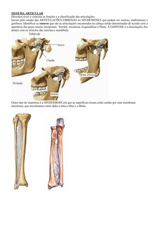 SISTEMA ARTICULAR
Devemos rever o conceito as funções e a classificação das articulações.
Iniciar pelo estudo das ARTICULACÕES FIBROSAS ou SINARTROSES que podem ser suturas, sindesmoses e
gonfoses. Identificar as suturas que são as articulações encontradas na cabeça sendo denominadas de acordo com a
aparência das peças ósseas interpostas: Serrátil, escamosa, Esquindilese e Plana. A GONFOSE é a articulações dos
dentes com os alvéolos das maxilas e mandíbula.
Outro tipo de sinartrose é a SINDESMOSE em que as superfícies ósseas estão unidas por uma membrana
interóssea, que encontramos entre rádio e ulna e tíbia e a fíbula.
 