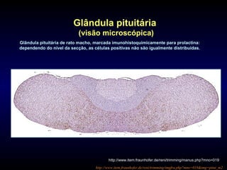 Glândula pituitária de rato macho, marcada imunohistoquimicamente para prolactina:
dependendo do nível da secção, as células positivas não são igualmente distribuídas.
http://www.item.fraunhofer.de/reni/trimming/imgfra.php?mno=019&img=pitui_m2
Glândula pituitária
(visão microscópica)
http://www.item.fraunhofer.de/reni/trimming/manus.php?mno=019
 