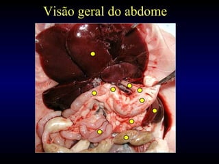 Visão geral do abdome
 