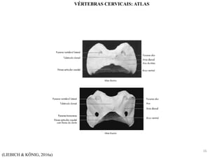 (LIEBICH & KÖNIG, 2016a)
VÉRTEBRAS CERVICAIS: ATLAS
16
 