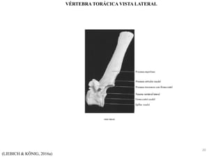 (LIEBICH & KÖNIG, 2016a)
VÉRTEBRA TORÁCICA VISTA LATERAL
20
 