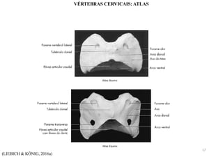 (LIEBICH & KÖNIG, 2016a)
VÉRTEBRAS CERVICAIS: ATLAS
17
 
