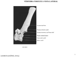 (LIEBICH & KÖNIG, 2016a)
VÉRTEBRA TORÁCICA VISTA LATERAL
21
 