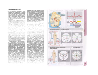 Electrocardiograma (ECG)
El ECG muestra las diferencias de poten-
cial (pocos mV) producidas por la excitación
cardiaca. Nos aporta información sobre la po-
sición del corazón, sobre la frecuencia y ritmo
cardíaco, sobre el origen del ritmo cardíaco y
sobre la transmisión del impulso, la desapari-
ción de la excitación y sus alteraciones, pero
no sobre la contracción y la acción de bomba
del corazón.
Los potenciales del ECG se originan en la
zona fronteriza entre el miocardio excitado y el
no excitado. Un miocardio no excitado o exci-
tado por completo no determina ningún poten-
cial visible en el ECG. Mientras el frente de
excitación avanza por el músculo cardíaco se
producen numerosos potenciales de intensidad
y dirección distinta. Dichos vectores se repre-
sentan en forma de flechas, en las que la longi-
tud refleja la altura del potencial y la dirección la
dirección en la que se transmite el potencial
(punía de la flecha: +). Los numerosos vectores
individuales se suman entre sí (como un parale-
logramo de fuerzas) para calcular el vector
suma o integral (A, flecha roja). Su dirección
y longitud se modifican durante la excitación
cardiaca, de forma que la punta de la flecha del
vector suma describe trayectos en forma de la-
zos (A), que se pueden visualizar de forma osci-
lográfica en un uectorcardiograma.
Las derivaciones de las extremidades y
de la pared torácica del ECG permiten vi-
sualizar el curso temporal del vector suma, pro-
yectado sobre la derivación correspondiente.
Una derivación paralela al vector suma muestra
todo el latido (onda R, unos 1-2 mV), mientras
que una vertical no muestra ninguno. Las
derivaciones /, Il y /// de Einthoven (C) son
bipolares y se sitúan en el plano frontal. En las
deriuaciones unipolares de Goldberger (aVL,
ctVR y aVF, D) se compara, a diferencia de las
derivaciones 1 a HI, una extremidad (el brazo
derecho en el caso de aVR) con el punto de
unión de los otros dos electrodos. Este sistema
aumenta (aVR = aumentado) la oscilación de
las ondas. aVL, aVR y aVF se sitúan también
en el plano frontal. Las derivaciones unipolares
de Ia pared torácica V1 a V6 (Wilson; F) se si-
túan en el plano horizontal. Estas últimas deri-
vaciones permiten, junto con las anteriormente
descritas en el plano frontal, la representación
tridimensiona/ del vector suma. Vj a V6
se numeran desde el lado izquierdo del tórax,
de forma que los puntos de la derivación se si-
túen aproximadamente en el plano horizontal
(F). Como electrodos indiferentes se emplean
tres derivaciones de miembro conectadas con
una resistencia (5 kfl). Las derivaciones de IaJ
pared torácica permiten visualizar los vectores
dirigidos hacia la espalda, que producen un po-¡
tencial pequeño o no lo producen en el plano
frontal. Como el vector QRS medio se dirige
hacia abajo, izquierda y atrás, su aspecto es ne-
gativo en VI a V3 y positivo en V5 y V6.
En casos especiales se pueden colocar derivaciones en el
esófago a nivel de Ia pared torácica derecha (Vr3 a Vr6) y
de Ia parte Izquierda de Ia espalda (V7-V9) (F2).
Una curva de ECG (B y v. 195, C) muestra
ondas cuyo sentido es hacia arriba o haciái
abajo y entre ellas existen segmentos e inter-
valos. La onda P (<0,3 mV, <0,1 s) corres-
ponde a la despo/arización auricular, cuyaj
onda de repolarización no se suele visualizar
por quedar oculta en la onda siguiente. La
onda Q (mV <l/4 de R, <0,04 s) y las ondas
R y S (R + S >0,6 mV) se denominan juntas
complejo QRS (<0,1 s) (se llama así, aunque
falte uno de los componentes). El potencial del
vector QRS medio se calcula (mirando el
gráfico) como la suma de las alturas de las
ondas Q, R y S (por definición la R es la pri-
mera onda positiva del complejo, lo que
significa que ésta no es sincrónica en todas las
derivaciones). El complejo QRS corresponde
a la despolarización de los ventrículos y la
onda T a su repolarización. Aunque ambos
fenómenos son contrarios, la onda T y la
onda R muestran la misma dirección en la ma-
yoría de las derivaciones +, lo que implica que
la excitación y recuperación del miocardio no
suceden en la misma dirección (QRS y T en
195, C: flechas de vector dirigidas en la misma
dirección a pesar de la inversión de la carga
por reentrada de la excitación). El segmento
PQ (aurículas completamente excitadas) y
el segmento ST (ventrículos completamente
excitados) se localizan aproximadamente a
nivel de O mV. El intervalo PQ (desde el prin-
cipio de P al de Q; <0,2 s; B) se corresponde
con el tiempo de transmisión auricu/ouen-
tricuíar. El intervalo QT (desde el principio de
Q hasta el final de T) corresponde a la dura-
ción conjunta de la depolarización y repolari-
zación ventricular y depende de la frecuencia
 