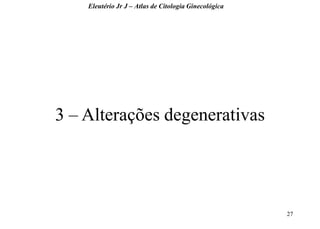 27 
3 – Alterações degenerativas 
Eleutério Jr J – Atlas de Citologia Ginecológica  