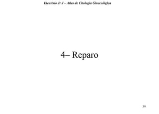 39 
4– Reparo 
Eleutério Jr J – Atlas de Citologia Ginecológica  