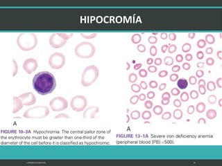 LATRODECTUS MACTANS 14
 