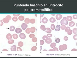 LATRODECTUS MACTANS 15
 