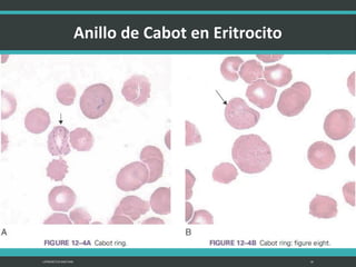 LATRODECTUS MACTANS 16
 